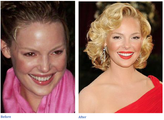 Celebrity Invisalign Katherine Heigl Dental Blog Dr Graham Tinkler